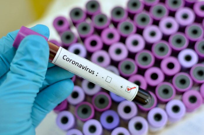 Coronavirus Calabria, ancora un giorno senza contagi nel Vibonese